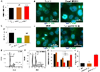 Figure 3: Ovarian carcinoma cells overexpressing BRD4-S isoform become arrested in G2/M phase of the cell cycle. 