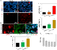 Figure 4: The BRD4-S overexpression or knockdown increases DNA damage in ovarian carcinoma cell lines. 