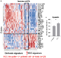 Figure 1: TGF-β pathway-related serum markers stratify HCC risk in cirrhotic patients (TPEARLE).