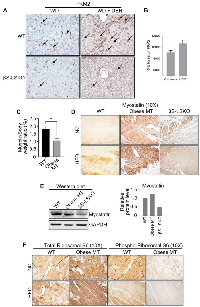 Figure 3: Expression of TGF-β driven mechanistic marker Myostatin and PKM2 in MASH/HCC mouse model.