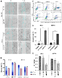Figure 3: The effects of the miR-377 on cell migration, apoptosis, and MTT of prostate cancer cell lines.