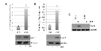 Figure 2:  Tumor cell derived factors induce Cox-2 expression in macrophages in an ADAM17-dependent manner. 