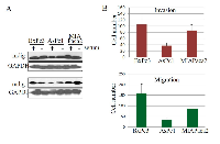 Figure 1: Expression of mdig in human pancreatic cancer cell lines. 