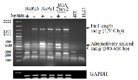 Figure 2:  Expression and alternative splicing of mdig mRNA in pancreatic cancer cell line. 