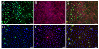 Figure 2:  Immunofluorescence detection of DDX3 in undifferentiated human ECCs. 