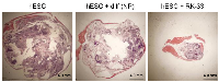 Figure 6:  RK-33 enhances differentiation and reduces teratoma formation. 
